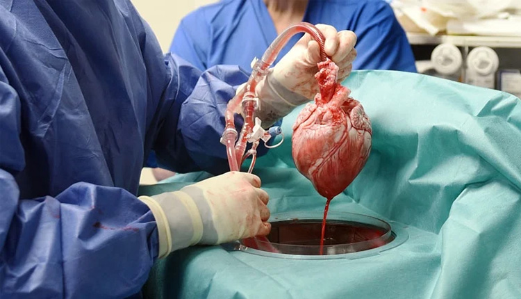 pig_heart_on_man